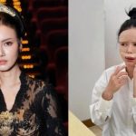 Nita Gunawan Spill Perubahan Wajah Usai Treatment Di Shanghai,