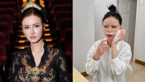 Nita Gunawan Spill Perubahan Wajah Usai Treatment Di Shanghai,