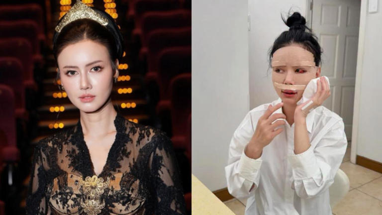 Nita Gunawan Spill Perubahan Wajah Usai Treatment Di Shanghai,
